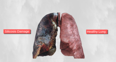 healthy-vs-nonhealthy-lung